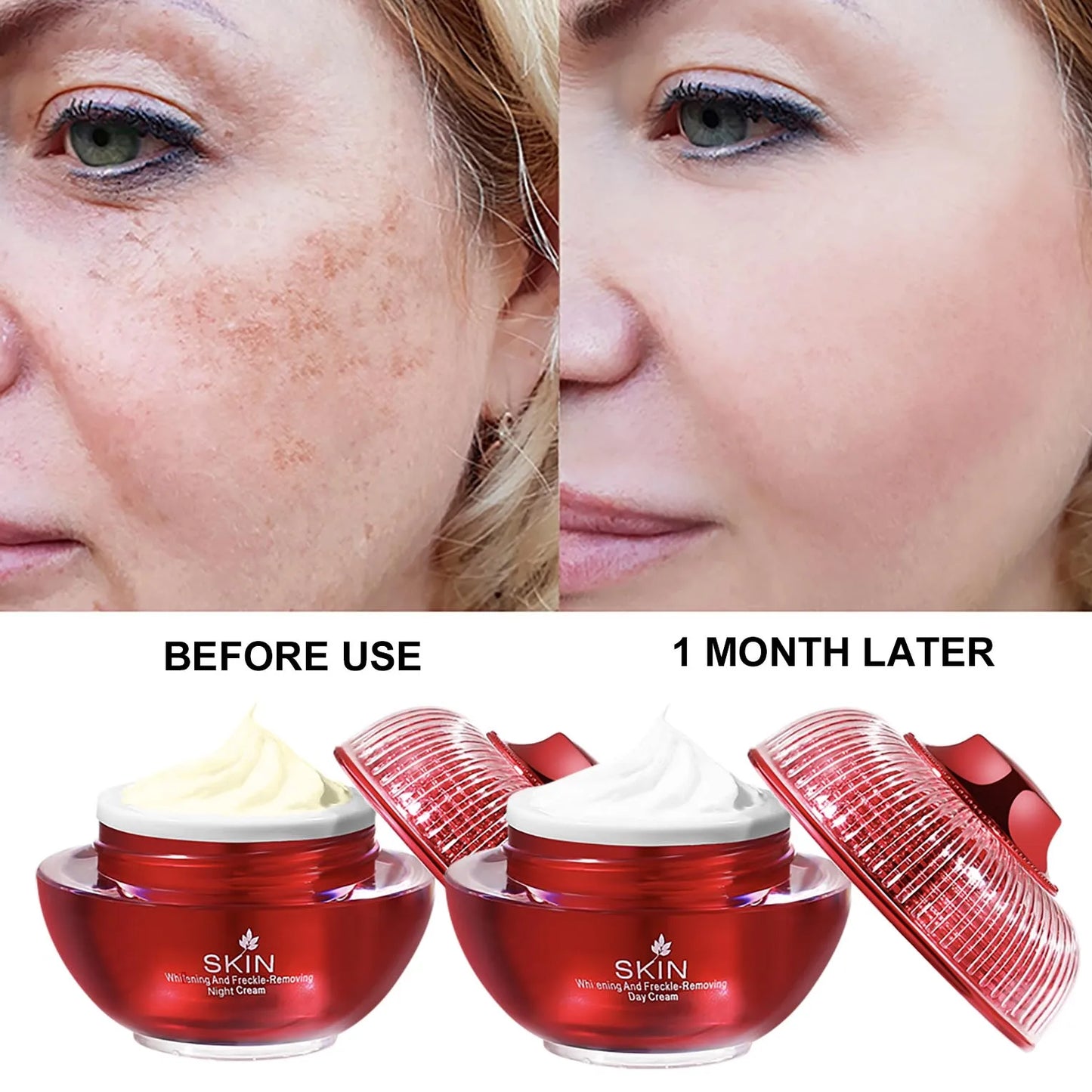 Anti-Aging Anti-Freckle Facial Cream